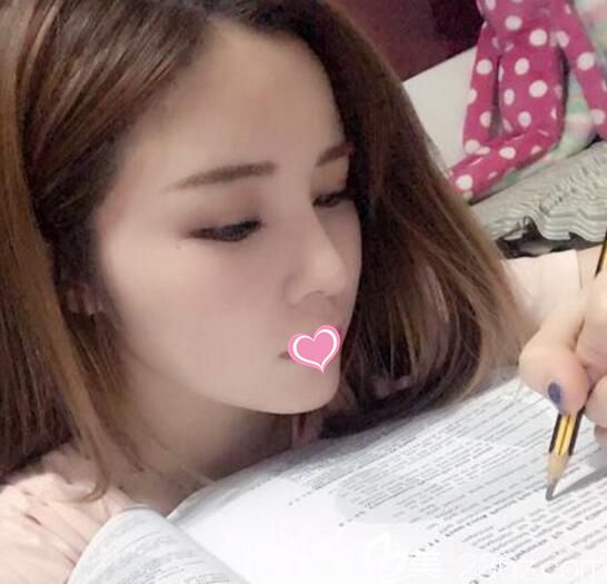 韓國(guó)清潭first假體隆鼻失敗修復(fù)案例 韓國(guó)清潭first假體隆鼻失敗修復(fù)案例