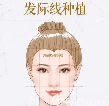 發(fā)際線種植比例