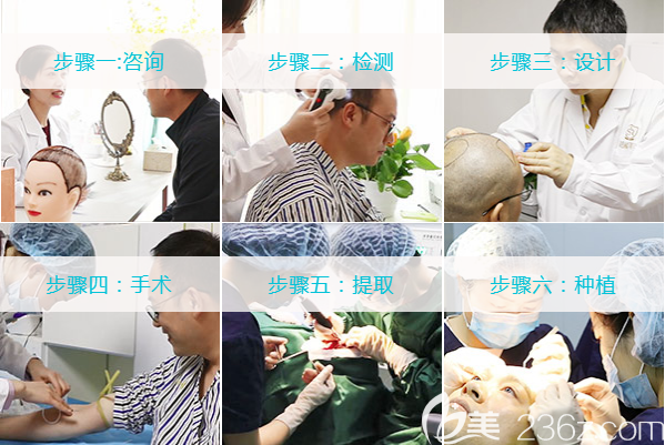 成都青羊首瑞毛發(fā)移植醫(yī)療美容診所植發(fā)流程