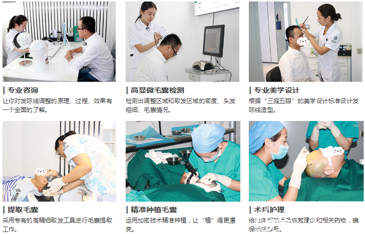 廣州青逸植發(fā)醫(yī)院植發(fā)過程圖 廣州青逸植發(fā)醫(yī)院植發(fā)過程圖