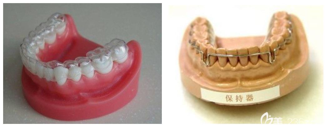 付艷麗醫(yī)生科普牙齒矯正后如何避免反彈 付艷麗醫(yī)生科普牙齒矯正后如何避免反彈