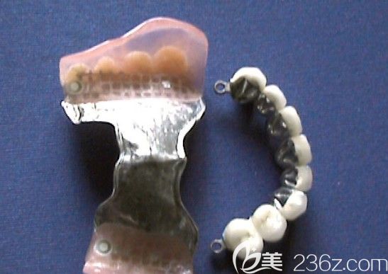 陳利明醫(yī)生講解活動(dòng)義齒的基托有哪幾種類型 陳利明醫(yī)生講解活動(dòng)義齒的基托有哪幾種類型