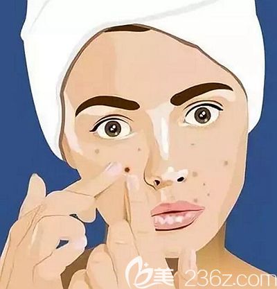 擠痘會容易留下痘印