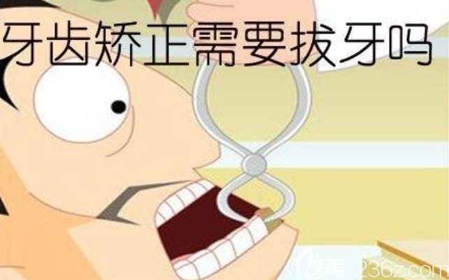 陳聰慧醫(yī)生講解整牙需要拔牙嗎 陳聰慧醫(yī)生講解整牙需要拔牙嗎