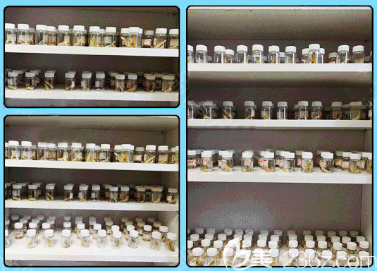 廣東廣州美恩徐威強(qiáng)做的改臉型<span style=