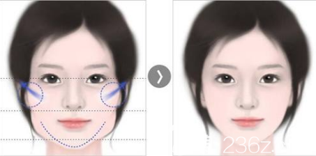 韓國女神醫(yī)院面部輪廓