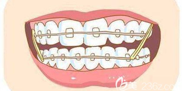 致美口腔經(jīng)驗(yàn)豐富的正畸醫(yī)生