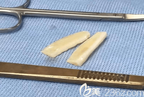 在韓國Profile普羅菲耳做貼發(fā)耳矯正使用的材料 在韓國Profile普羅菲耳做貼發(fā)耳矯正使用的材料