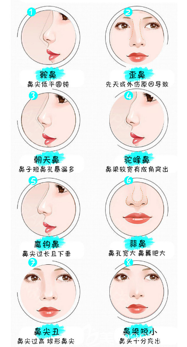 整形醫(yī)院可以解決各種鼻型問題