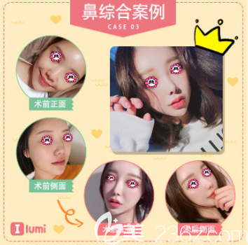 韓國一路美許宇辰<span style=