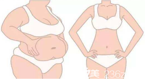 韓國必瘦B醫(yī)院溶脂優(yōu)勢