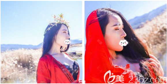 廣州壹加壹整形醫(yī)院隆胸怎么樣 廣州壹加壹整形醫(yī)院隆胸怎么樣