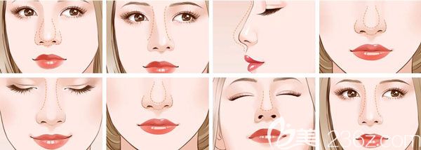 焦俊光院長做鼻子的優(yōu)勢