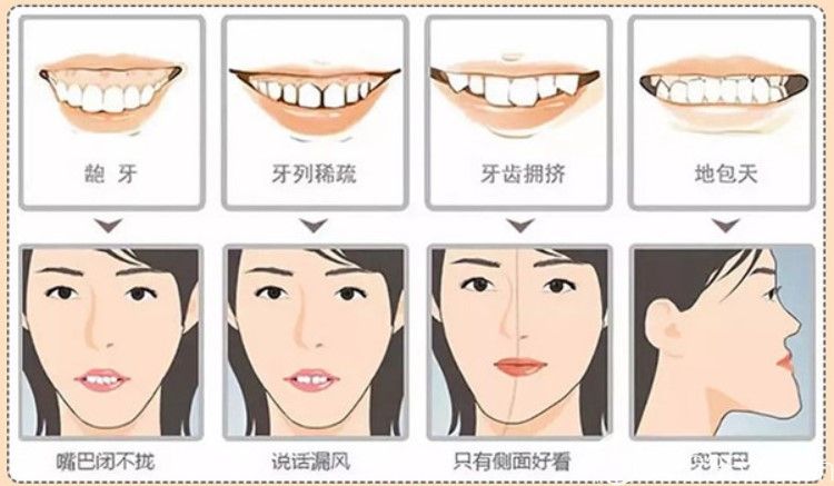 隱形牙套優(yōu)勢(shì)有哪些