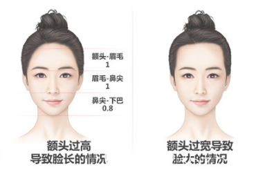 韓國毛杰琳整形醫(yī)院額頭縮小