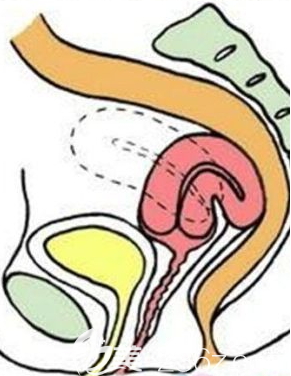 韓國(guó)TheClim醫(yī)院Viveve激光縮陰