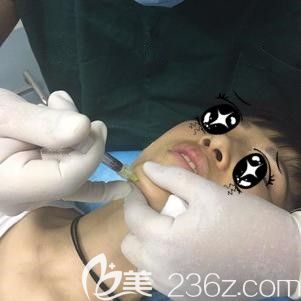 杜凱娟主任幫我注射伊婉玻尿酸術中即刻 杜凱娟主任幫我注射伊婉玻尿酸術中即刻