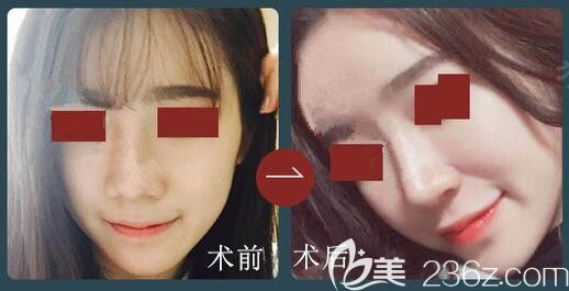 韓國鼻修復(fù)好的醫(yī)生推薦