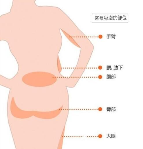 需要吸脂的部位展示 需要吸脂的部位展示