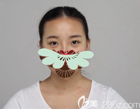 重慶華美發(fā)際線種植術(shù)前 重慶華美發(fā)際線種植術(shù)前