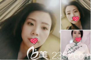 我也是做了一次雙眼皮才知道醫(yī)院怎么樣？各方面來講它的正規(guī)靠譜程度