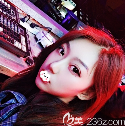 我找廣州韓妃牟北平做隆鼻子花了兩萬多元感覺性價比很高醫(yī)生也很靠譜