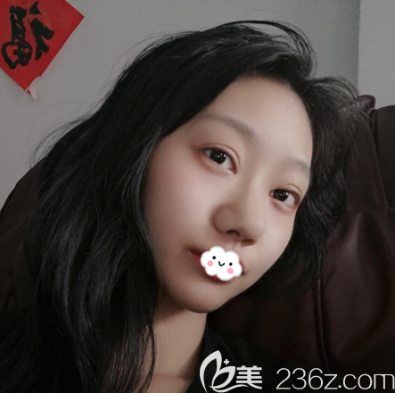 我找廣州韓妃牟北平做隆鼻子花了兩萬多元感覺性價比很高醫(yī)生也很靠譜 我找廣州韓妃牟北平做隆鼻子花了兩萬多元感覺性價比很高醫(yī)生也很靠譜