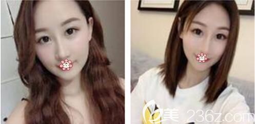 20天效果已經(jīng)挺明顯了