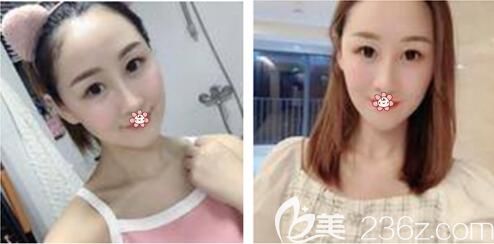 重慶美萊醫(yī)院正規(guī)嗎