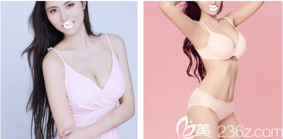 感覺身邊去深圳非凡隆胸的人挺多的于是我也慕名找梅夠明做了娜綺麗假體隆胸