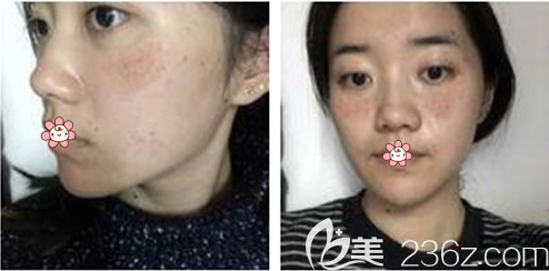 術(shù)前我的臉 術(shù)前我的臉