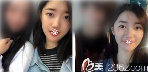 重慶美萊哪個(gè)醫(yī)生祛斑好 重慶美萊哪個(gè)醫(yī)生祛斑好