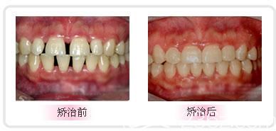 20191122_1574397345342706.jpg 20191122_1574397345342706.jpg