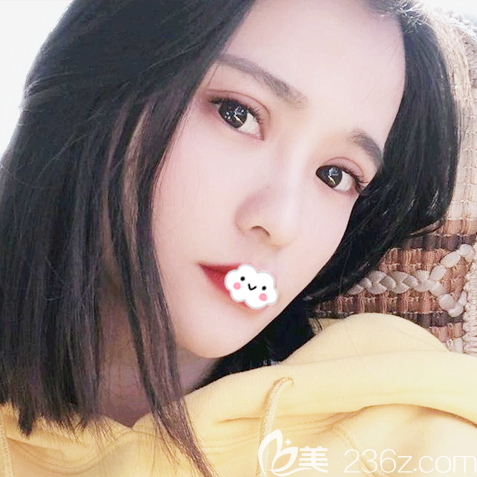 ?找東莞美立方做眼睛很好的張克醫(yī)生做完雙眼皮修復(fù)后拿到一份割雙眼皮價格表