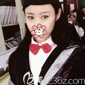 5張割雙眼皮恢復(fù)日記圖揭曉連云港榜上有名的眼部整形醫(yī)師孫振東到底技術(shù)怎樣