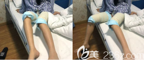 術(shù)前 術(shù)前