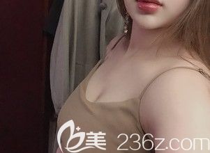 說自體脂肪隆胸一個月后小了的可能是腫脹，看我在阜陽做后90天還是那樣的大那樣的軟