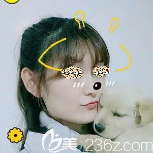 到合肥藝星做皮秒激光祛斑術(shù)后36天皮膚白凈 到合肥藝星做皮秒激光祛斑術(shù)后36天皮膚白凈