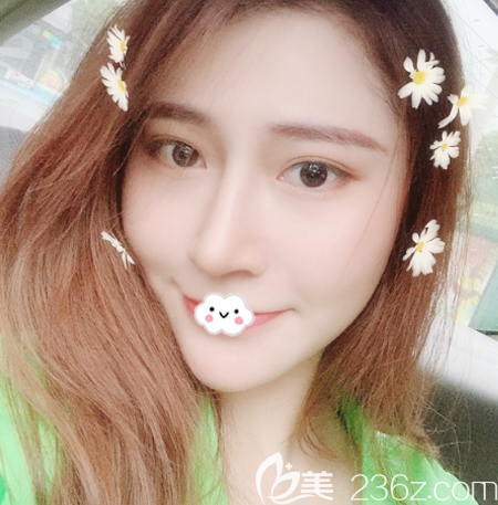 找正規(guī)靠譜的廣州紫馨整形醫(yī)院谷琪做完肋軟骨隆鼻后拿到一份整形價格表