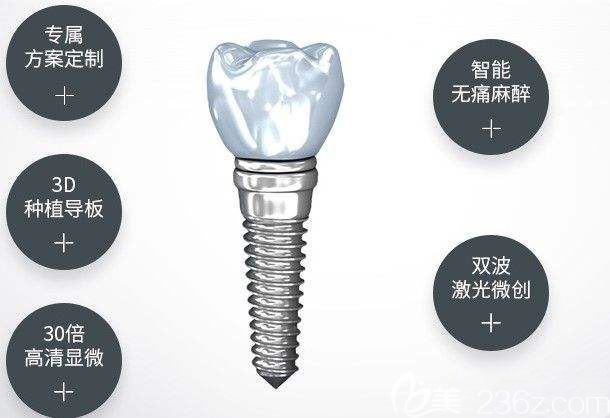 種植體結(jié)構(gòu)示意圖