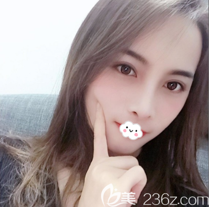 <!--<i data=20240703-sp></i>-->醫(yī)院眼睛鼻子案例一個(gè)月效果