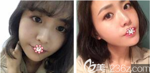 <!--<i data=20240703-sp></i>-->主任給我做完手術(shù)后10天