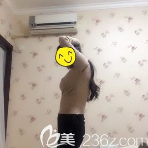 易胖MM投稿真人案例：選太原華美做腰腹吸脂后終于和肚子上松弛的肉肉說再見了