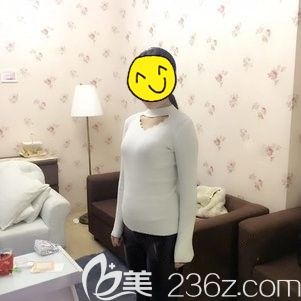 尹醫(yī)生做腰部吸脂術(shù)后30天針孔消失