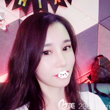 我能成功逆襲是因?yàn)檎覐V州藝美整形張濤做了自體脂肪全臉填充和雙眼皮隆鼻哦