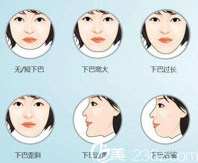常見下巴癥狀
