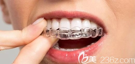 陸開盛院長談隱形牙套矯正的優(yōu)勢 陸開盛院長談隱形牙套矯正的優(yōu)勢