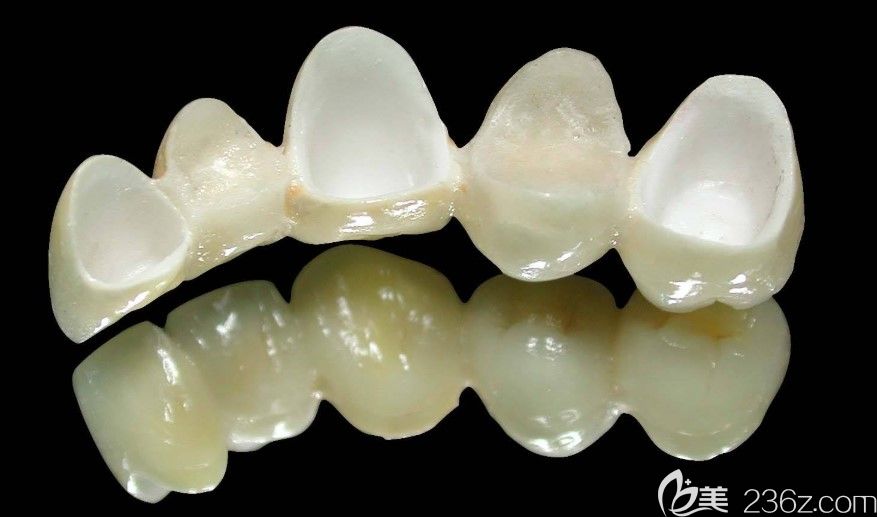 岑志平解析:全瓷牙能用多久 岑志平解析:全瓷牙能用多久