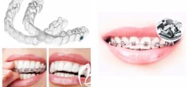深圳徠可口腔牙齒矯正 深圳徠可口腔牙齒矯正