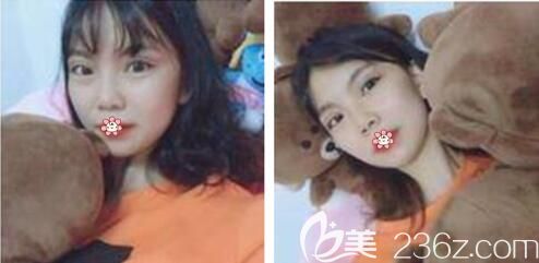 半個(gè)月那會兒